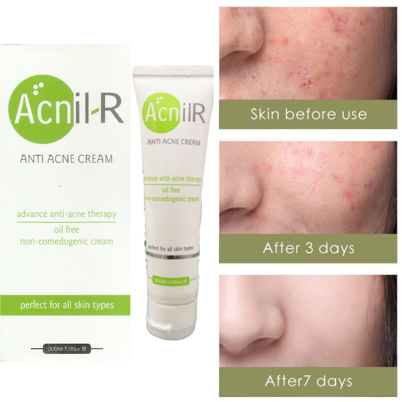 Acnil-R Anti Acne Cream Oil Free Non-comedogenic Cream