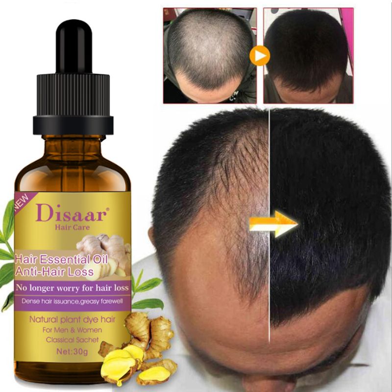 Disaar Anti Hair Loss Essential Oil No Longer Worry for Hair Loss