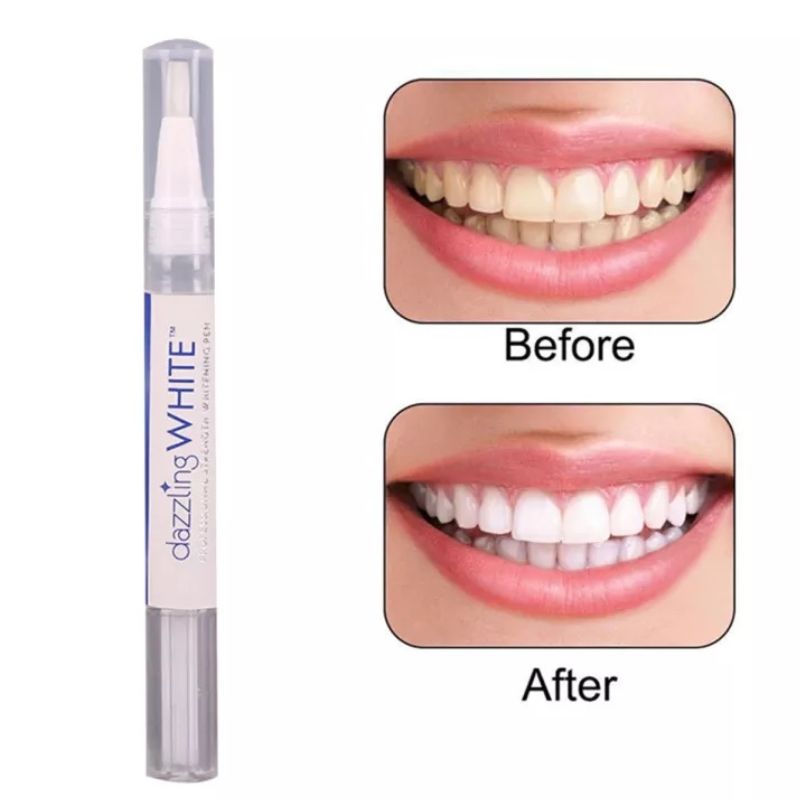 Instant Teeth Whitening Pen - Dazzling White