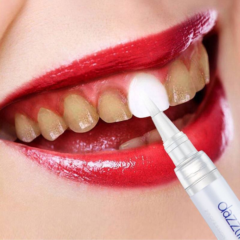 Instant Teeth Whitening Pen - Dazzling White