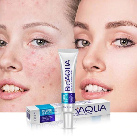 BIOAQUA Acne Removal Cream + Acne Removal Moisturizing Mask Pack of 2
