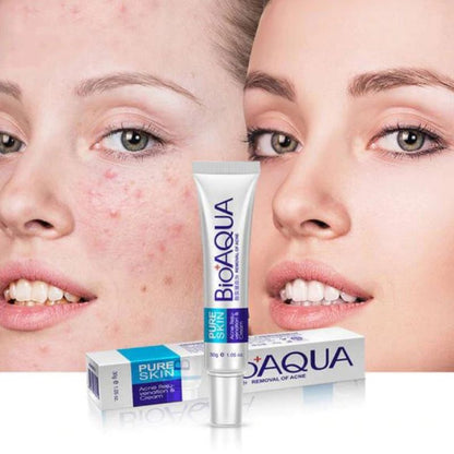 BIOAQUA Acne Removal Cream + Acne Removal Moisturizing Mask Pack of 2