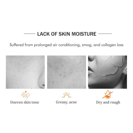 Aichun Beauty VC & Nicotinamide Face Mask Anti-aging Whitening