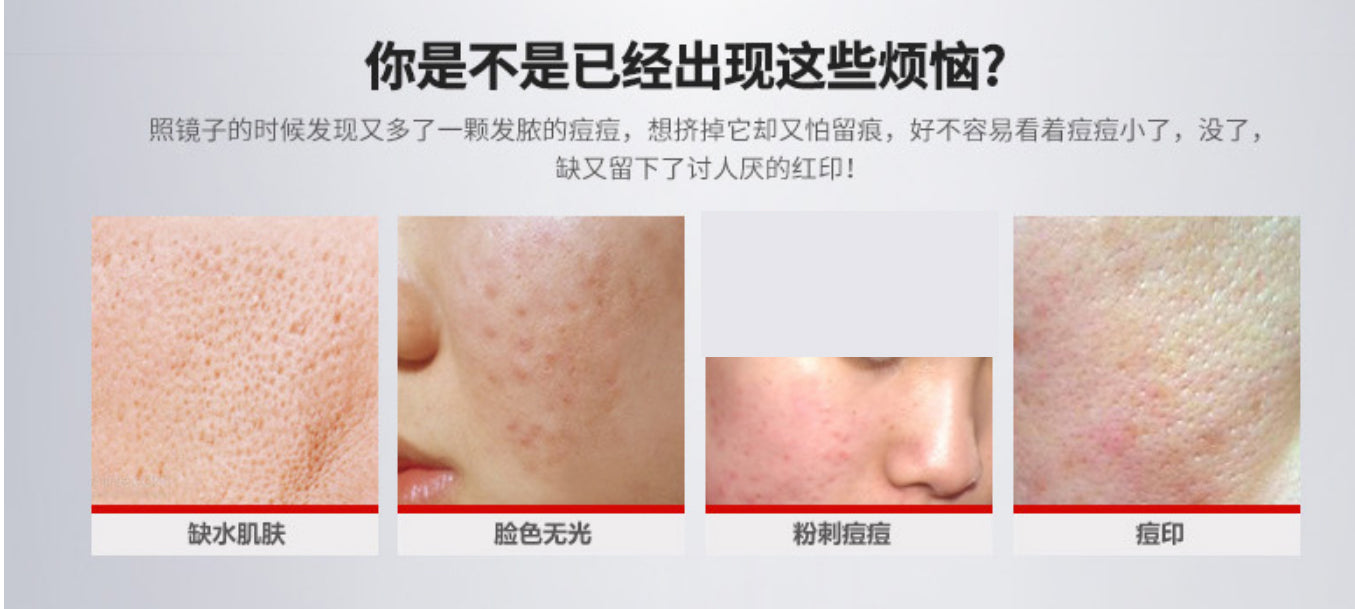 BIOAQUA Anti Acne Face Cleanser Best Facial Cleanser for Acne-Prone Skin