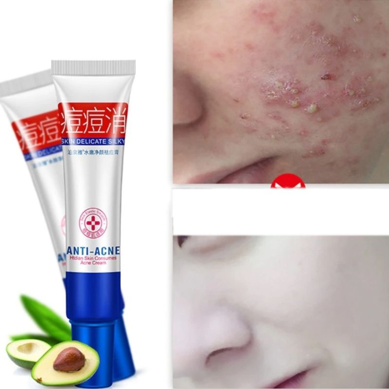 BioAqua Acne Elimination Anti Acne Cream