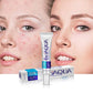 BIOAQUA Acne Removal Cream Fast & Affordable Acne Treatment