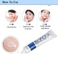 BIOAQUA Acne Removal Cream Fast & Affordable Acne Treatment