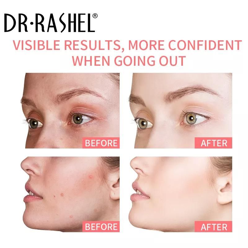 Dr Rashel Pink Mineral Clay Stick Whitening Complex