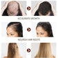 Disaar Anti Hair Loss Essential Oil No Longer Worry for Hair Loss