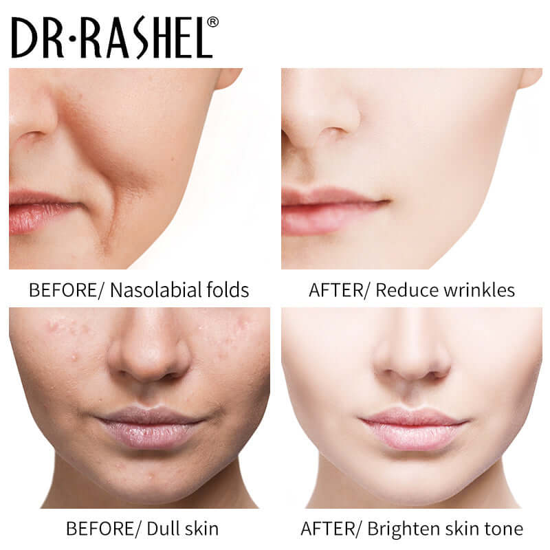 Dr Rashel VC Face Wash Reduces Redness and Brightens Your Complexion