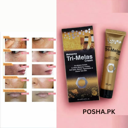 Tri Melas Cream By Dr Romia